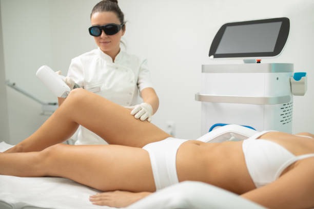 laser hair removal services